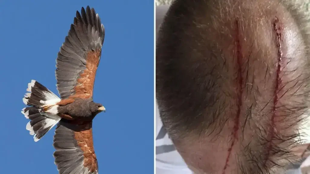 Eagle Attack On Head Astrology